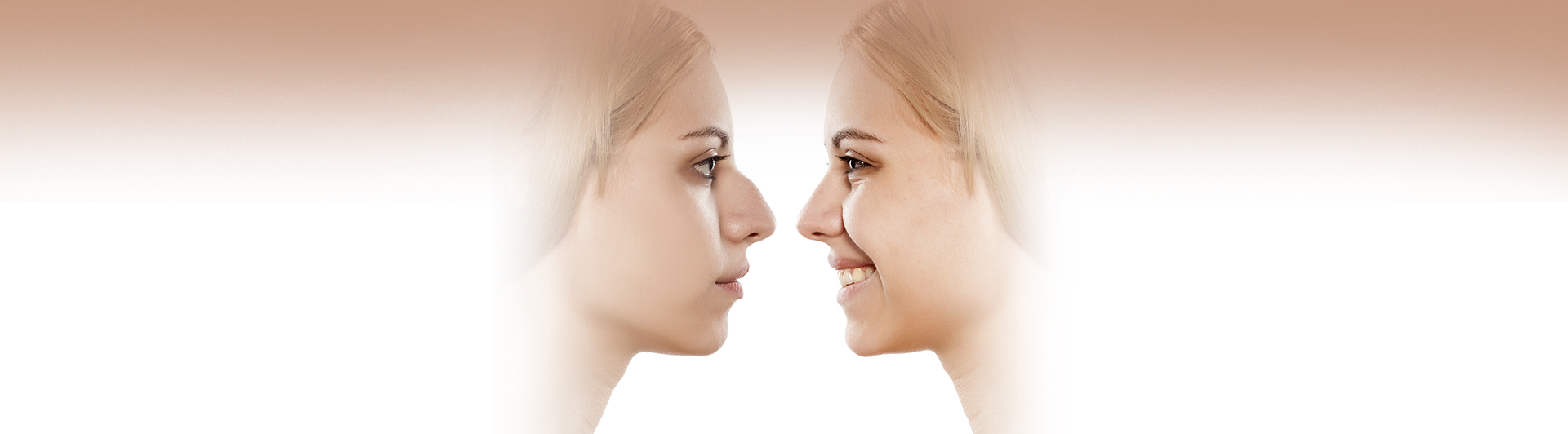 Rhinoplasty Surgery in Tarzana