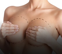 Breast Implants